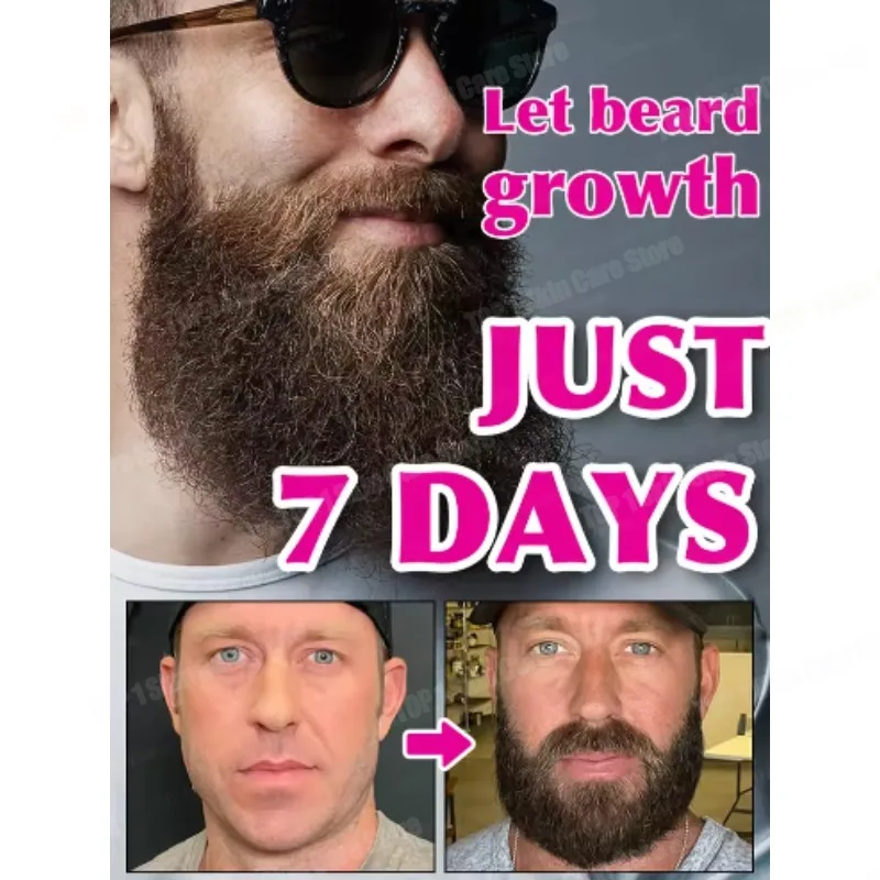 Beard growth essence. It helps your beard grow quickly, and is a must-have for mature men. It makes you look more manly and is e
Beard growth essence. It helps your beard grow quickly, and is a must-have for mature men. It makes you look more manly and is e