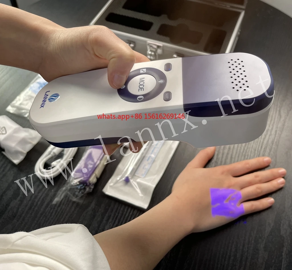 500A Handheld Infrared Light Emitting Diode Vein Detector Medical Equipment Laboratory and Hospital Transmission Devices
500A Handheld Infrared Light Emitting Diode Vein Detector Medical Equipment Laboratory and Hospital Transmission Devices