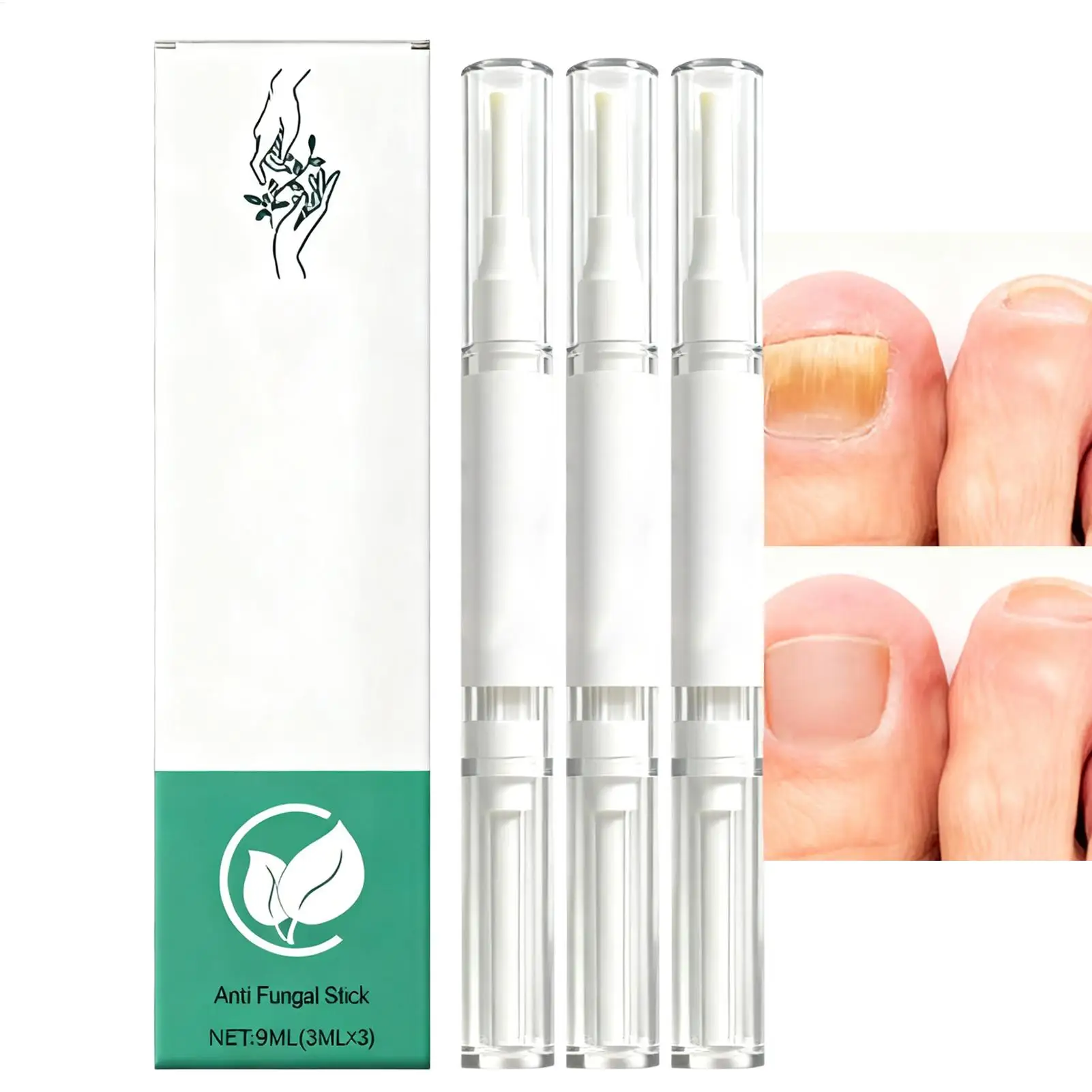 Nail Nourishing Pen Cuticle Oil Nail Revitalizer Nutrition Oil Soften Nourish Manicure Nail Care Nail Cuticle Revitalizer Oil
Nail Nourishing Pen Cuticle Oil Nail Revitalizer Nutrition Oil Soften Nourish Manicure Nail Care Nail Cuticle Revitalizer Oil