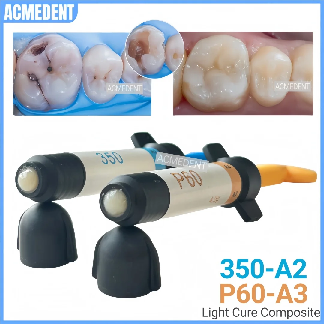 Dental P60-A3 350-A2 Light-curing Composite Resin Veneer Whitening Teeth Filling Material Anterior Posterior Tooth Restorative 
Dental P60-A3 350-A2 Light-curing Composite Resin Veneer Whitening Teeth Filling Material Anterior Posterior Tooth Restorative