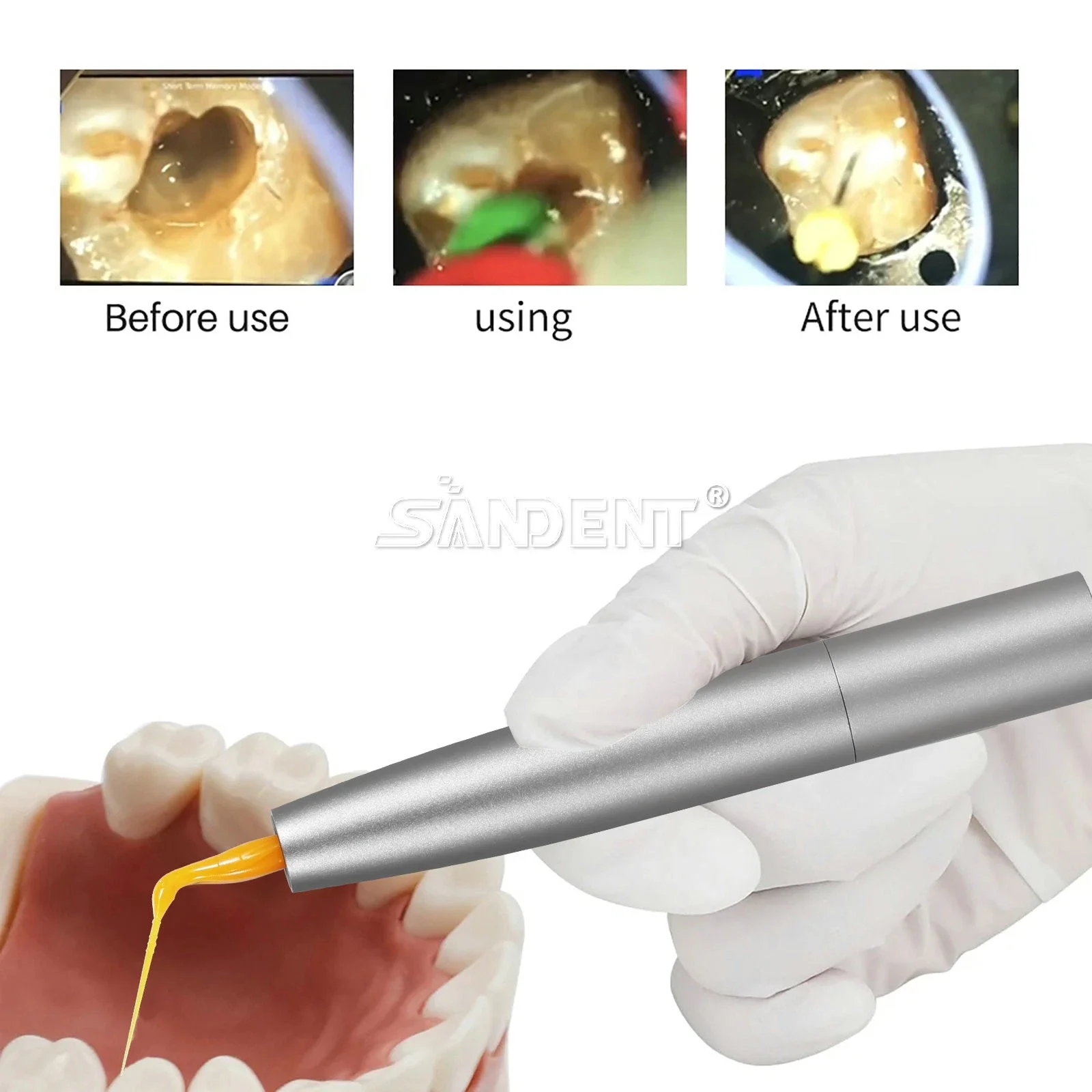 Dental (Fiber Optic LED) Sonic Powered Endo Irrigator Handpiece Irrigation Air Scaler For Kavo Quick Coupler/30pcs Tips
Dental (Fiber Optic LED) Sonic Powered Endo Irrigator Handpiece Irrigation Air Scaler For Kavo Quick Coupler/30pcs Tips