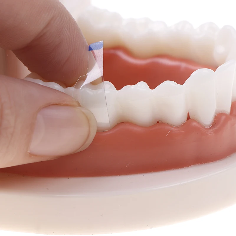 30Pcs/box Dental Transparent Sectional Contoured Matrices Matrix Anterior And Posterior Teeth Polyester Dental Materials
30Pcs/box Dental Transparent Sectional Contoured Matrices Matrix Anterior And Posterior Teeth Polyester Dental Materials