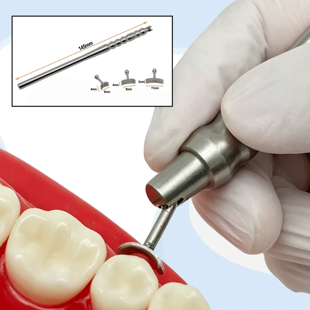 Dental Implant Gingival Protector Socket Shield Retractor with 3 Replaceable Tips for Gum Separation and Isolation
Dental Implant Gingival Protector Socket Shield Retractor with 3 Replaceable Tips for Gum Separation and Isolation