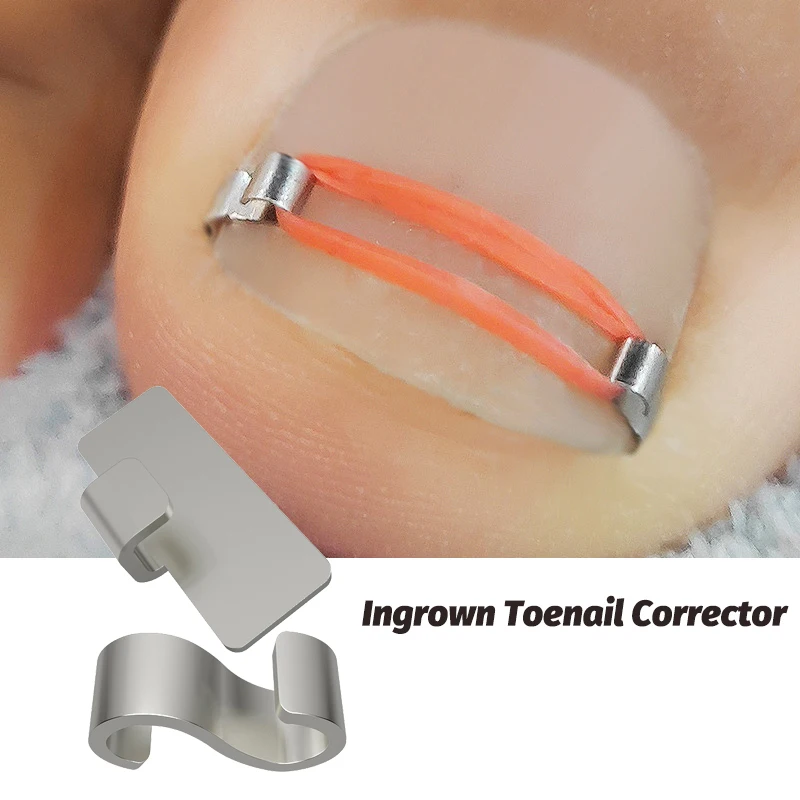 1/2pc Ingrown Toenail Corrector Pedicure Recover Embed Toe Nail Treatment Professional Ingrown Toenail Correction Foot Care Tool
1/2pc Ingrown Toenail Corrector Pedicure Recover Embed Toe Nail Treatment Professional Ingrown Toenail Correction Foot Care Tool