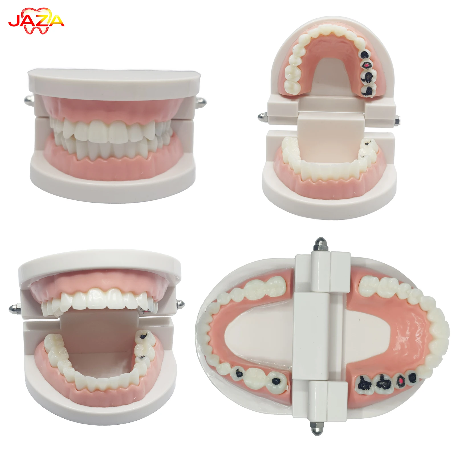 Учебная модель зубов с каримозитом | Съемные зубы с имитацией пульпы и кариеса | Практическое учебное пособие для стоматологии
Учебная модель зубов с каримозитом | Съемные зубы с имитацией пульпы и кариеса | Практическое учебное пособие для стоматологии