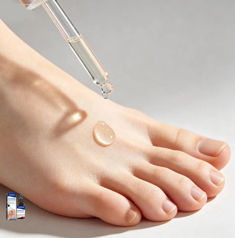 Nail Fungals Renewal Nail Repair Liquid for Discolored Thickened Crumbled Nails Nail Fungals for Discolored Broken Cracked
Nail Fungals Renewal Nail Repair Liquid for Discolored Thickened Crumbled Nails Nail Fungals for Discolored Broken Cracked