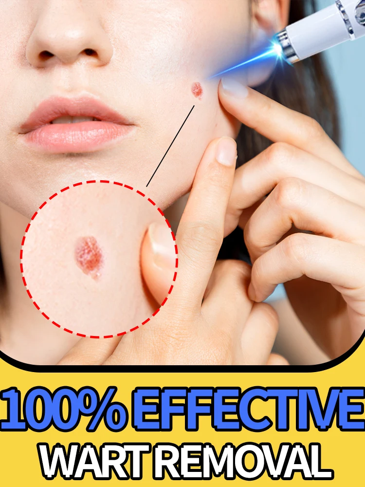 Witness the smooth transformation in 7 daysˢᶜⁱᵉⁿᵗⁱᶠⁱᶜᵃˡˡʸ ˡⁱᵍʰᵗᵉⁿ ʷᵃʳᵗˢ ᵃⁿᵈ ʳᵉᵇᵘⁱˡᵈ ʸᵒᵘʳ
Witness the smooth transformation in 7 daysˢᶜⁱᵉⁿᵗⁱᶠⁱᶜᵃˡˡʸ ˡⁱᵍʰᵗᵉⁿ ʷᵃʳᵗˢ ᵃⁿᵈ ʳᵉᵇᵘⁱˡᵈ ʸᵒᵘʳ