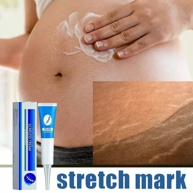 Stretch Marks Permanent Removal Cream Eliminate Body Belly Stretch Marks Swelling Marks Remove Skin Cracks Repair Firming Care
Stretch Marks Permanent Removal Cream Eliminate Body Belly Stretch Marks Swelling Marks Remove Skin Cracks Repair Firming Care