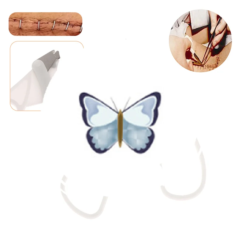 1 шт., белый одноразовый степлер для кожи, машинка для стрижки ногтей, хирургический инструмент для удаления швов на кожу, инструмент для удаления ногтей из нержавеющей стали + пластика
1 шт., белый одноразовый степлер для кожи, машинка для стрижки ногтей, хирургический инструмент для удаления швов на кожу, инструмент для удаления ногтей из нержавеющей стали + пластика