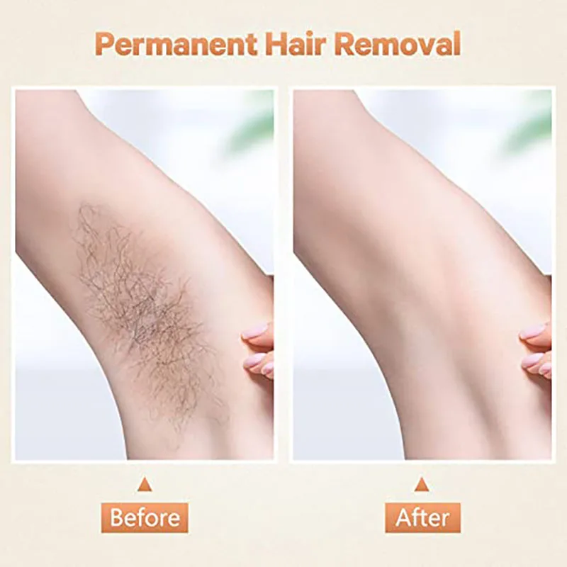 B69A IPL Hair Removal For Women And Men Permanent Painless Hair Removal System 300,000 Flashes Hair Remover Treatment
B69A IPL Hair Removal For Women And Men Permanent Painless Hair Removal System 300,000 Flashes Hair Remover Treatment