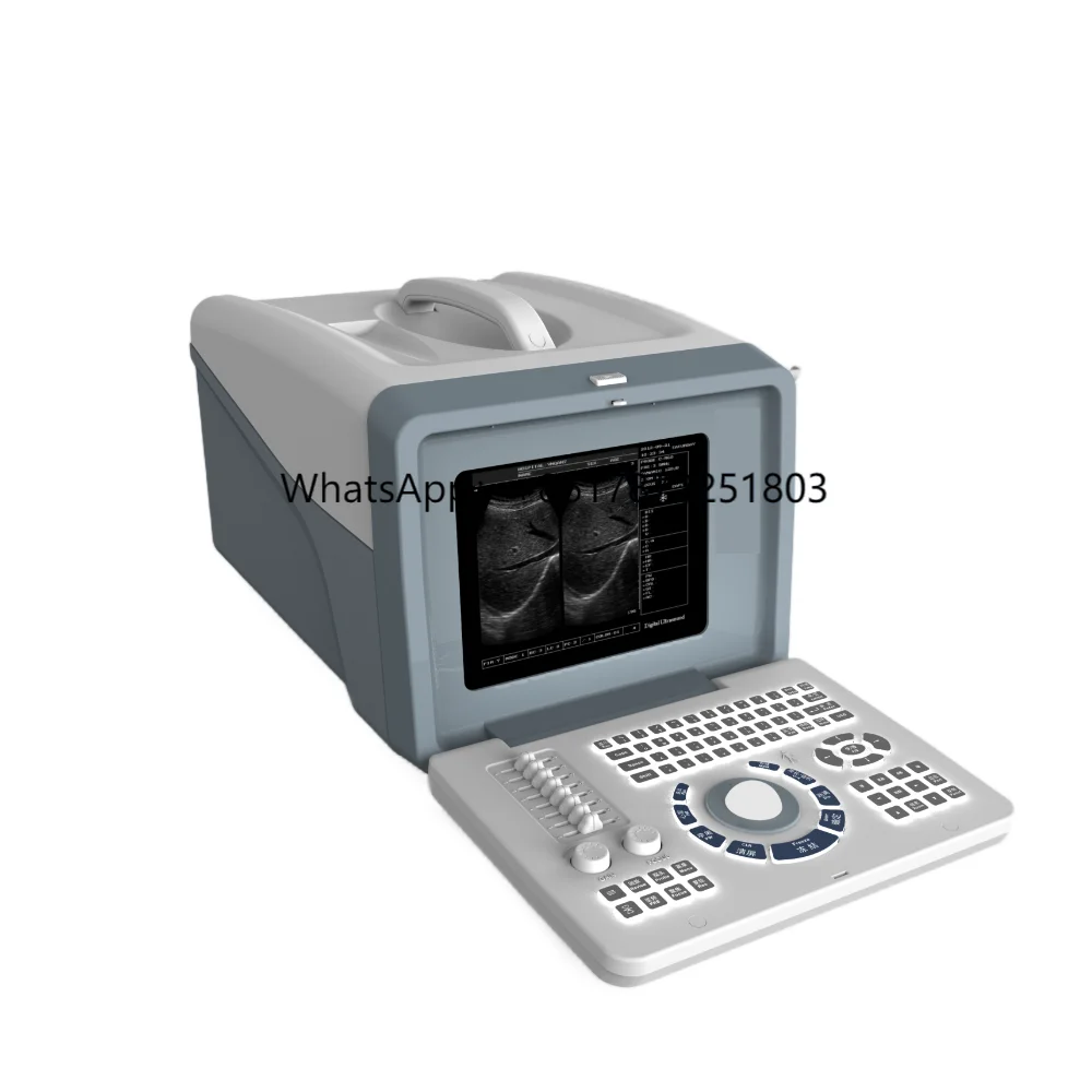 Portable Full Digital Veterinary Ultrasound Scanner for Animals and Humans B/W Electric Power Source for Medical Use
Portable Full Digital Veterinary Ultrasound Scanner for Animals and Humans B/W Electric Power Source for Medical Use