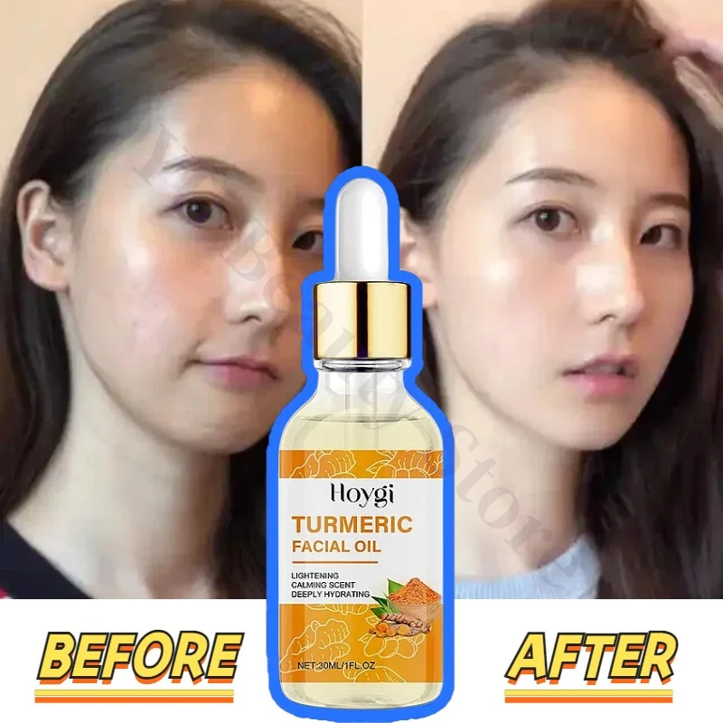 Hoygi Turmeric Essence Oil Dry Skin Whitening Spot Removal Facial Serum Shrink Pores Firming Moisturizing Brighten Gentle Care
Hoygi Turmeric Essence Oil Dry Skin Whitening Spot Removal Facial Serum Shrink Pores Firming Moisturizing Brighten Gentle Care
