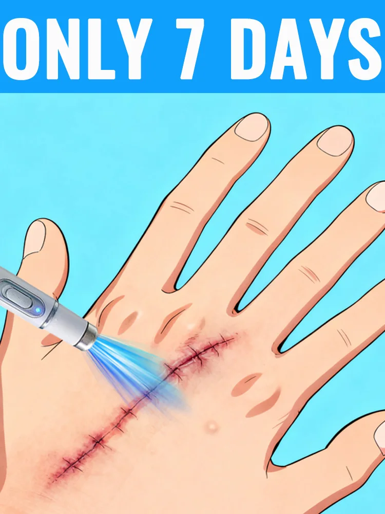 Generation-2 Laser Says Goodbye To all scars In 7 Days
Generation-2 Laser Says Goodbye To all scars In 7 Days