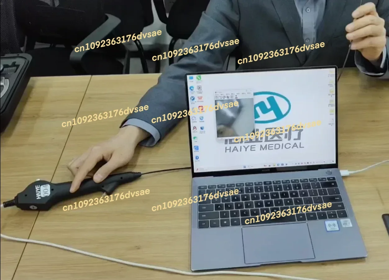 NEW advanced economical single-use flexible video ureteroscope ureteroscopy device for urological treatment
NEW advanced economical single-use flexible video ureteroscope ureteroscopy device for urological treatment