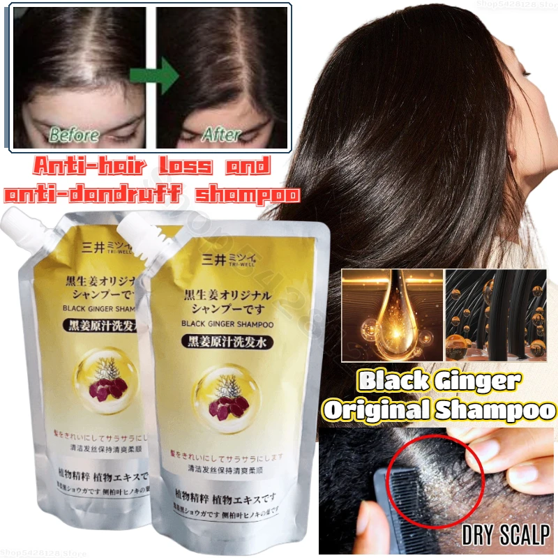Оригинальный шампунь Black Ginger против перхоти, глубокое очищение кожи головы, Укрепляющий шампунь для корней волос, 248 мл
Оригинальный шампунь Black Ginger против перхоти, глубокое очищение кожи головы, Укрепляющий шампунь для корней волос, 248 мл