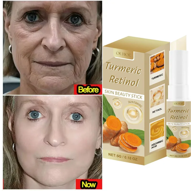 Instant Wrinkle Removal Multi Bounce Balm Facial Tightening Moisturizing Korean Anti-Wrinkle Balm Stick Cream Skin Care Products
Instant Wrinkle Removal Multi Bounce Balm Facial Tightening Moisturizing Korean Anti-Wrinkle Balm Stick Cream Skin Care Products