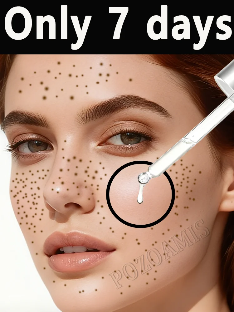 Скажи прощай к "Любованному лицу маски! Слой на основе осветления и пятен quietly «Disappear».
Скажи прощай к "Любованному лицу маски! Слой на основе осветления и пятен quietly «Disappear».