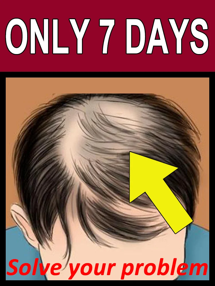 Быстро впитывается. Глубоко проникает в кожу головы. 100% эффективность, верните себе уверенность. Унисекс, ХИТ ПРОДАЖ.
Быстро впитывается. Глубоко проникает в кожу головы. 100% эффективность, верните себе уверенность. Унисекс, ХИТ ПРОДАЖ.