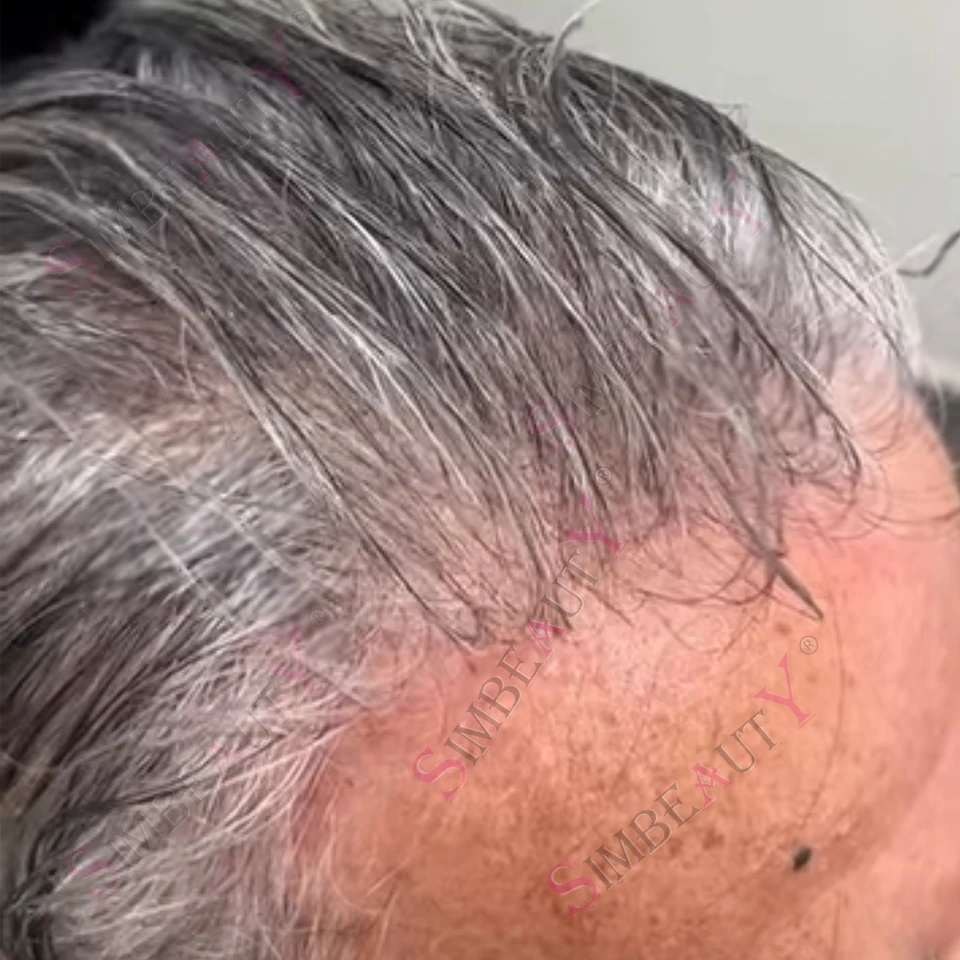 Легкий 80% плотность 0,02 мм, ультратонкая кожа, невидимая линия роста волос, белый, серебристый, серый, черный 1B65 1B80, мужской парик, система протезов блондинки
Легкий 80% плотность 0,02 мм, ультратонкая кожа, невидимая линия роста волос, белый, серебристый, серый, черный 1B65 1B80, мужской парик, система протезов блондинки