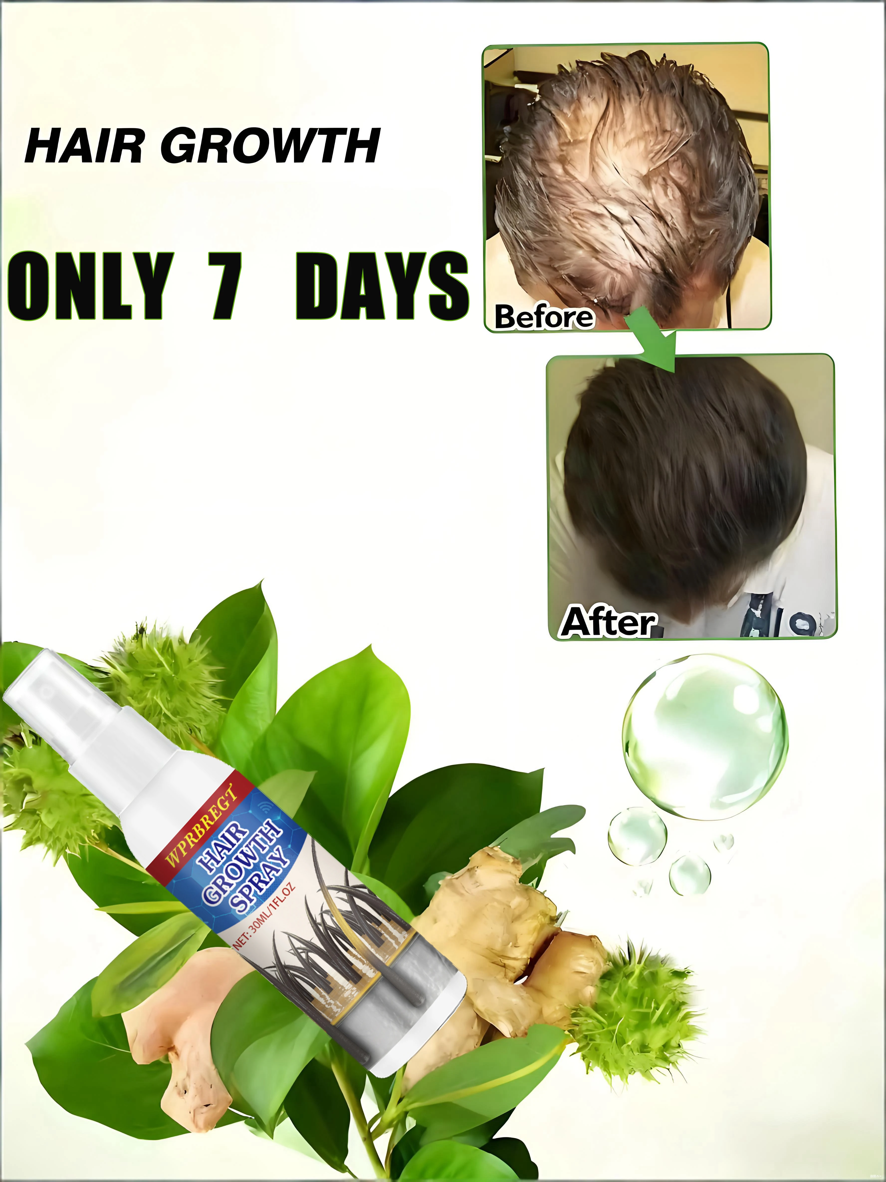 Научная формула может напрямую мишень корня выпадения волос и спрей может спать густым волосам.
Научная формула может напрямую мишень корня выпадения волос и спрей может спать густым волосам.