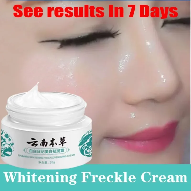 Крем Melasma Pekas Remover Оригинальный коллагеновый крем для удаления веснушек Pekas Отбеливающий крем для кожи веснушек
Крем Melasma Pekas Remover Оригинальный коллагеновый крем для удаления веснушек Pekas Отбеливающий крем для кожи веснушек