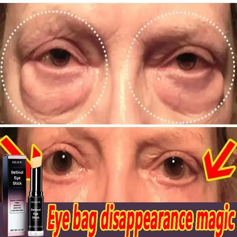 Instant Eye Bag Removal Cream Collagen Anti-Wrinkle Fade Fine Lines Firming Skin Anti Dark Circle Puffiness Brighten Eye Care
Instant Eye Bag Removal Cream Collagen Anti-Wrinkle Fade Fine Lines Firming Skin Anti Dark Circle Puffiness Brighten Eye Care