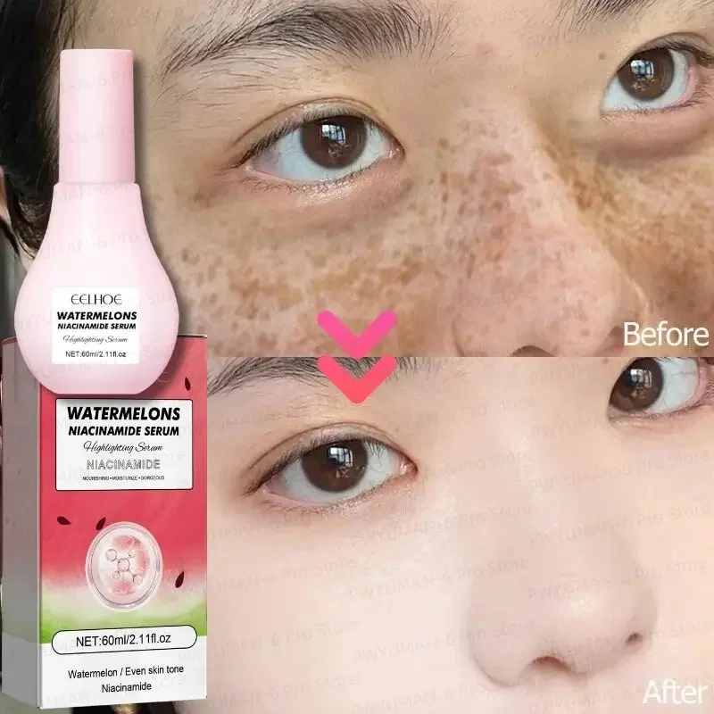 Watermelon Nicotinamide Essence Dark Spots Remover Glow Recipe Cosmetics Moisturize Lotion Serum Whitening Brighten Skin Makeup
Watermelon Nicotinamide Essence Dark Spots Remover Glow Recipe Cosmetics Moisturize Lotion Serum Whitening Brighten Skin Makeup