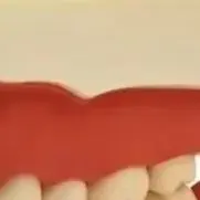 Removable Dental Teeth Model for Tooth Preparation Exercise with Screwdriver Teaching Aid for Dental Students And Professionals
Removable Dental Teeth Model for Tooth Preparation Exercise with Screwdriver Teaching Aid for Dental Students And Professionals