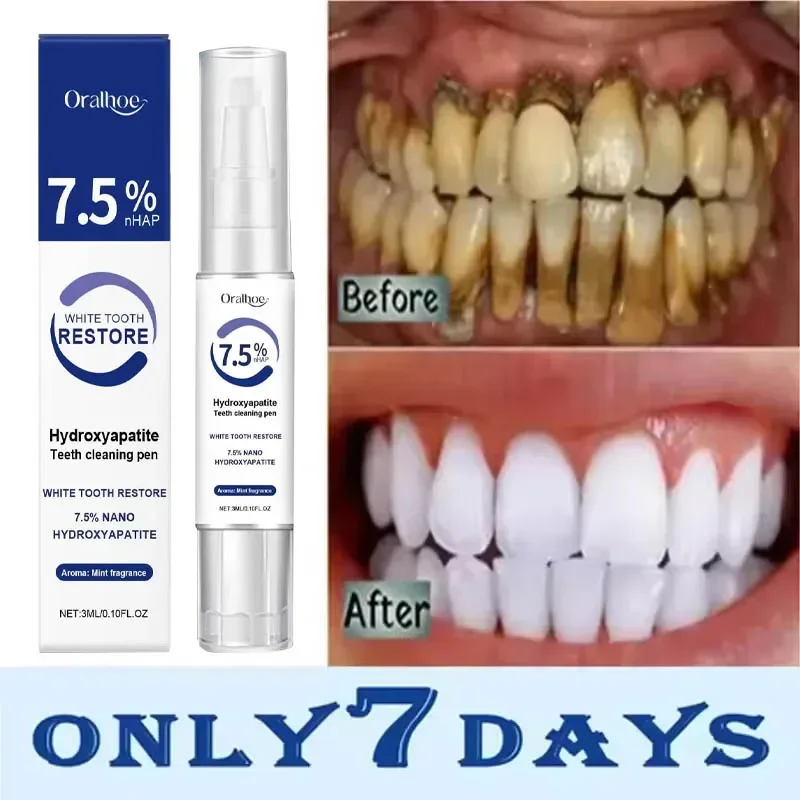 Stylo de soins dentaires, taches de thé des dents propres et rafraîchissantes, améliore la luminosité des dents, soins doux,
Stylo de soins dentaires, taches de thé des dents propres et rafraîchissantes, améliore la luminosité des dents, soins doux,