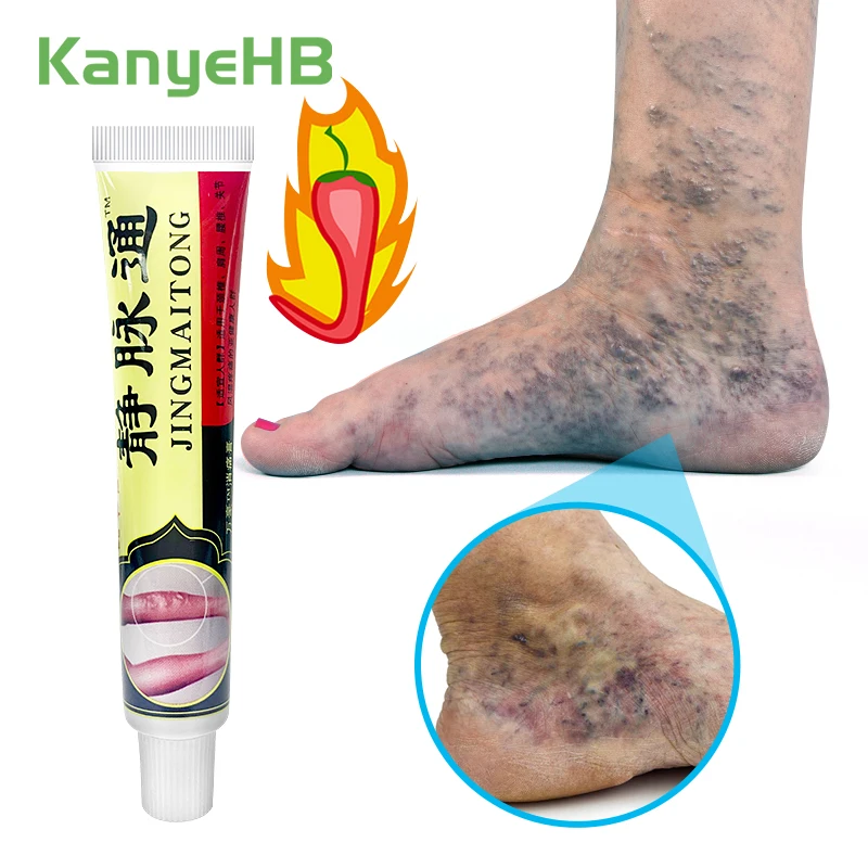 1pcs Leg Varicose Vein Ointment Vein Protrusion Improve Vascular Wall Varicosity Treatment Cream Smooth Leg Blood Vessels S084
1pcs Leg Varicose Vein Ointment Vein Protrusion Improve Vascular Wall Varicosity Treatment Cream Smooth Leg Blood Vessels S084