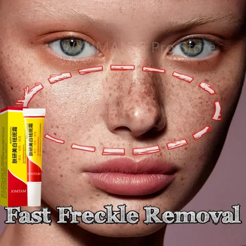Face Brightening Cream Niacinamide Reduce Chloasma Melasma Melanin Fade Fine Lines Lighten Dark Skin Serum Care Brighten Cream
Face Brightening Cream Niacinamide Reduce Chloasma Melasma Melanin Fade Fine Lines Lighten Dark Skin Serum Care Brighten Cream