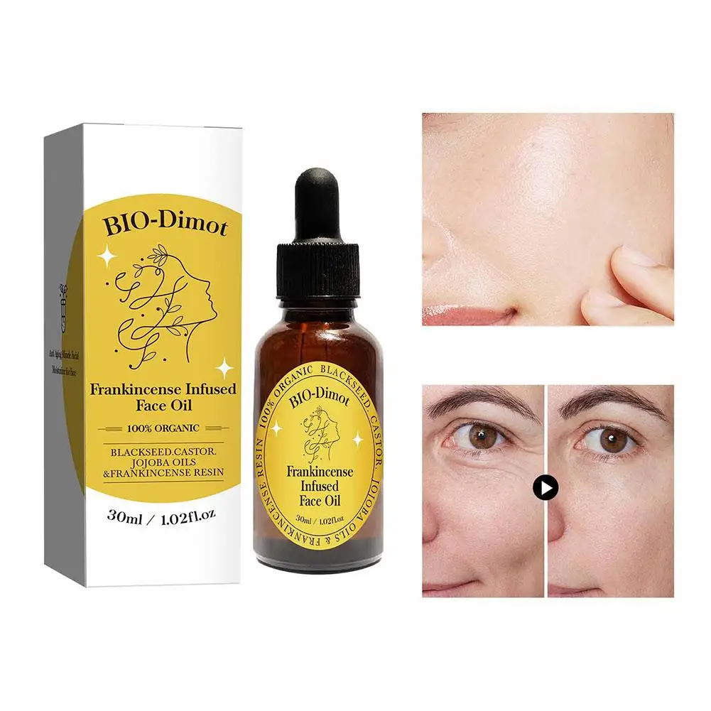 30ML Frankincense Resin Infused Organic Black Seed Oil For Face Skin Moisturizer Natural Cold Pressed Nourishing Skin Care K2V1
30ML Frankincense Resin Infused Organic Black Seed Oil For Face Skin Moisturizer Natural Cold Pressed Nourishing Skin Care K2V1