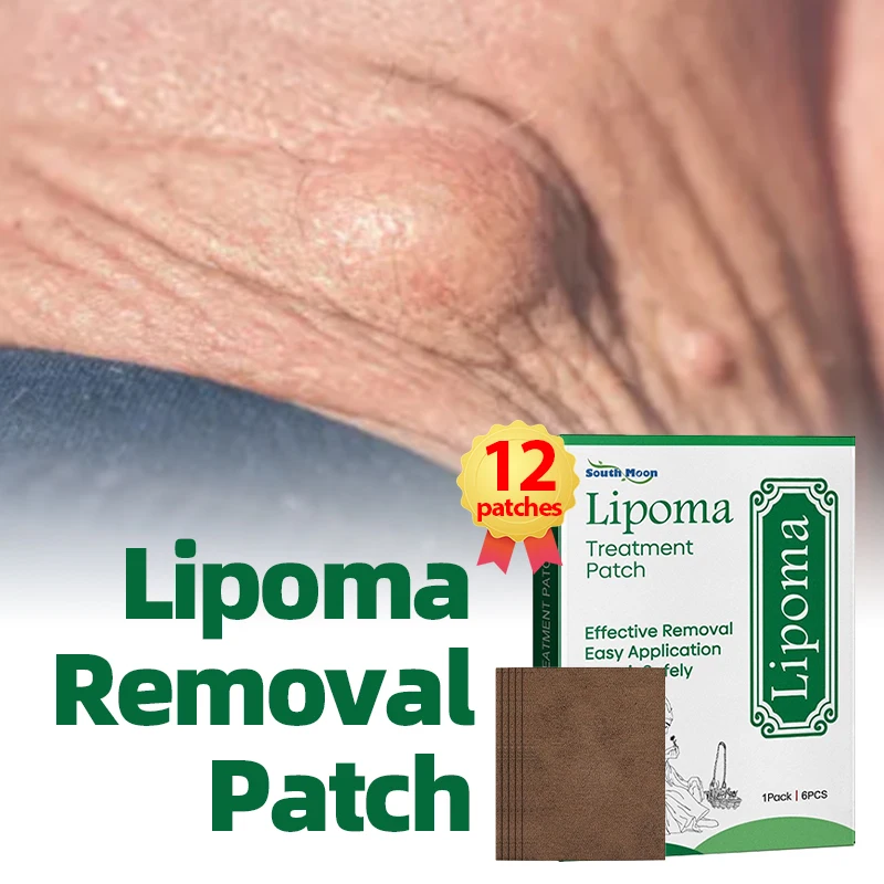 Lipoma Treatment Patch Fat Mass Fibroma Cellulite Removal Solitary Multiple Lipoma Scyst Fat Lump Remover Hua Tuo Medicine
Lipoma Treatment Patch Fat Mass Fibroma Cellulite Removal Solitary Multiple Lipoma Scyst Fat Lump Remover Hua Tuo Medicine