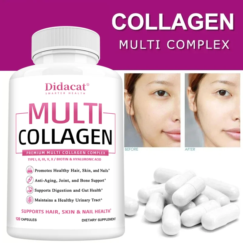 Multi Collagen Capsules Type I II III V X, Anti-Aging Supports Radiant Skin, Strong Hair Nails, Joint Cartilage & Bone Health
Multi Collagen Capsules Type I II III V X, Anti-Aging Supports Radiant Skin, Strong Hair Nails, Joint Cartilage & Bone Health
