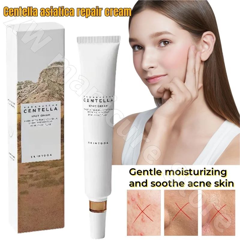 Skin1004 Centella Asiatica Repair Cream Gently Moisturizes Moisturizes Acne Skin Improves Dryness and Dullness Melanin 20ml
Skin1004 Centella Asiatica Repair Cream Gently Moisturizes Moisturizes Acne Skin Improves Dryness and Dullness Melanin 20ml