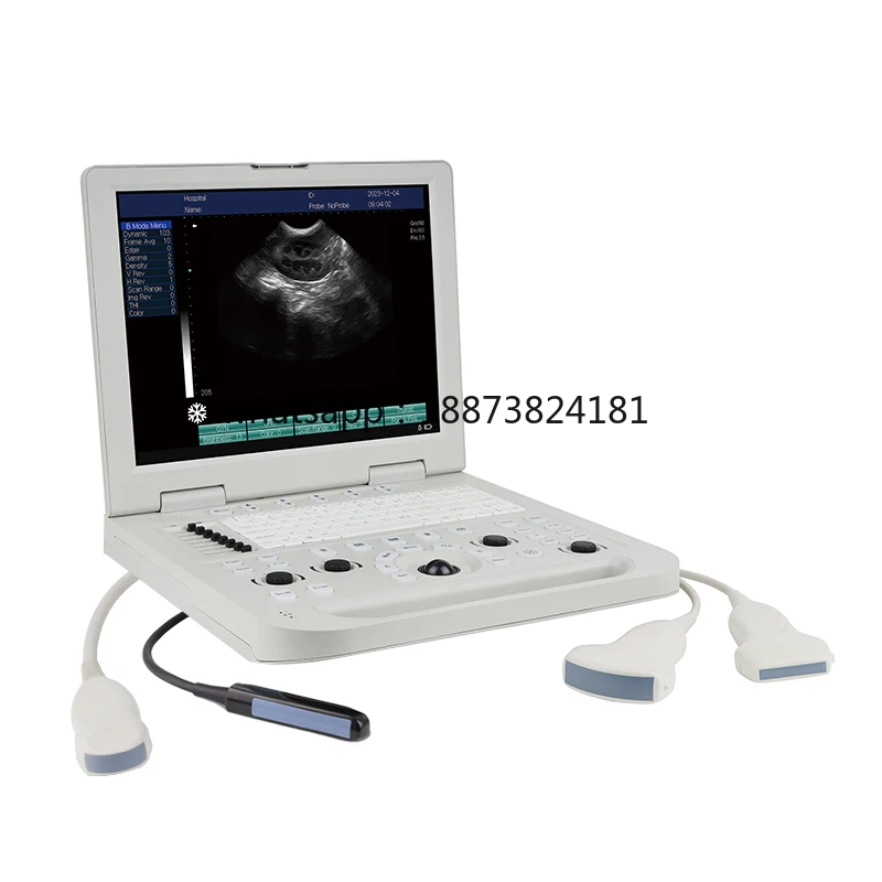 N20 15-Inch Convex Probe Veterinary Scanner Laptop Machine Veterinary fast shipping
N20 15-Inch Convex Probe Veterinary Scanner Laptop Machine Veterinary fast shipping