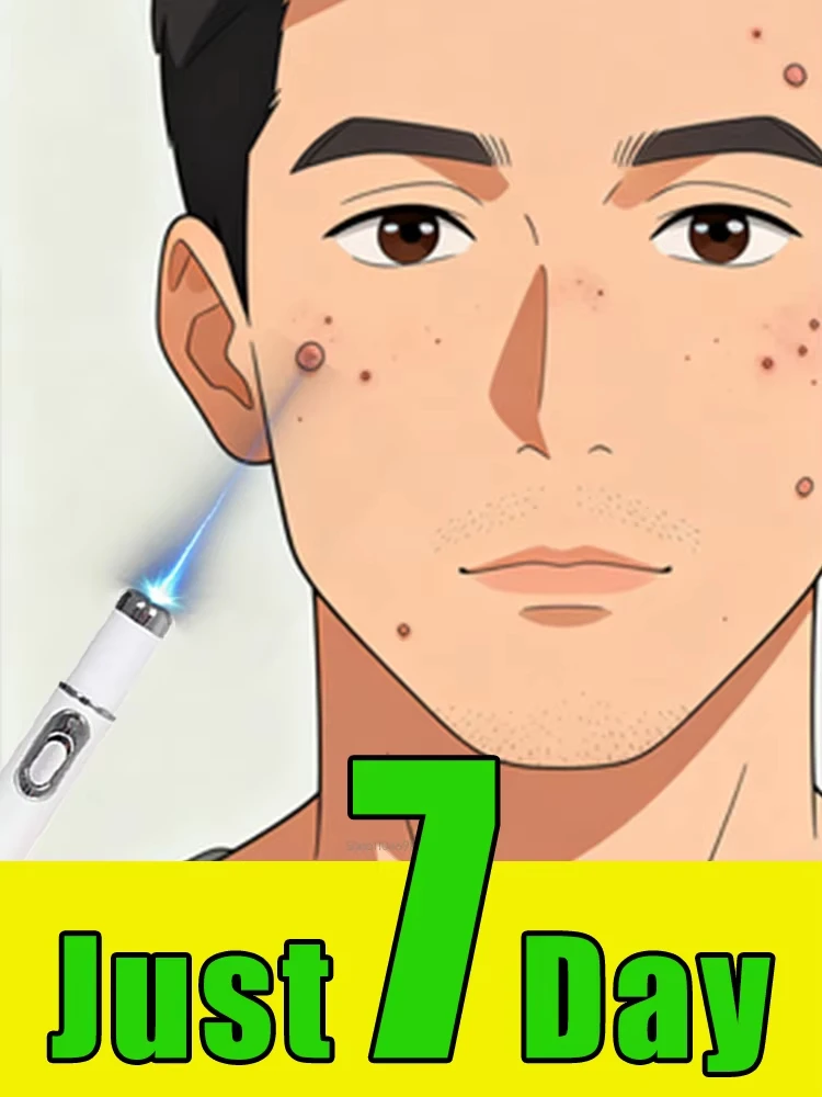 Outil Wart Blue Light, plus de réductions sur les ensembles
Outil Wart Blue Light, plus de réductions sur les ensembles