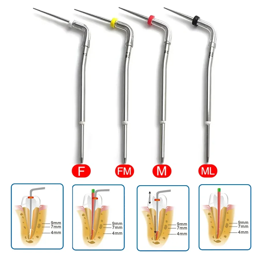 4Pcs Dental Accessories Dental Gutta Percha Pen Heated Tips Obturation System F Fm M Ml Root Canal Tips Dentist Heated Tips Tool
4Pcs Dental Accessories Dental Gutta Percha Pen Heated Tips Obturation System F Fm M Ml Root Canal Tips Dentist Heated Tips Tool