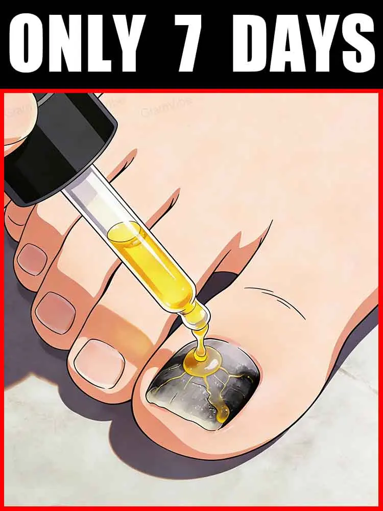 ᴺᵃⁱˡ ᶠᵘⁿᵍᵘˢ ᵗʳᵉᵃᵗᵐᵉⁿᵗ!Say Goodbye to Yellow Dullness
ᴺᵃⁱˡ ᶠᵘⁿᵍᵘˢ ᵗʳᵉᵃᵗᵐᵉⁿᵗ!Say Goodbye to Yellow Dullness