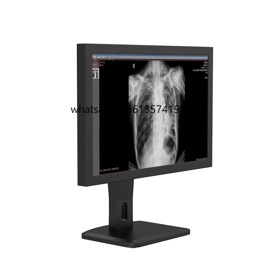 High Accuracy Diagnostic Medical Lcd Display, Latest HD Medical Display, LCD Display
High Accuracy Diagnostic Medical Lcd Display, Latest HD Medical Display, LCD Display