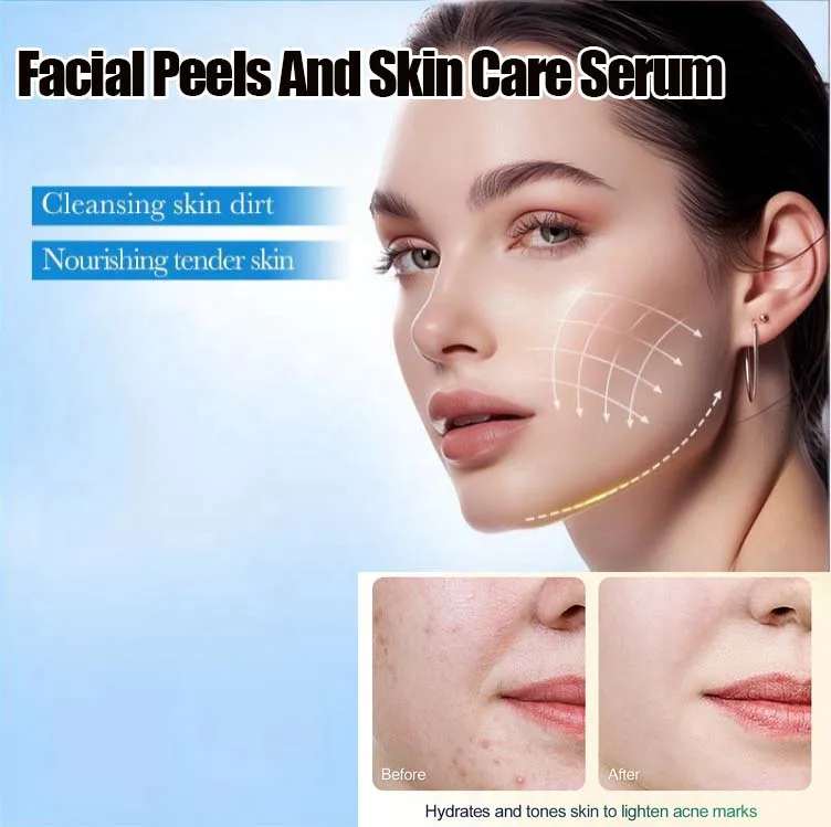Face Care Exfoliating Serum Radiant Skin Fade Dark Spots Pigmentation for Even Brighter Skin Remove Spots Arm Knee Legs Melanin
Face Care Exfoliating Serum Radiant Skin Fade Dark Spots Pigmentation for Even Brighter Skin Remove Spots Arm Knee Legs Melanin
