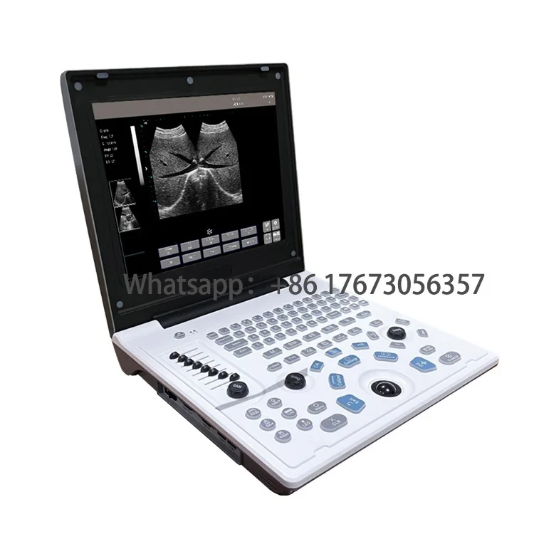 Китайская фабрика, низкая цена, сканер животных HY5520, ноутбук B/W, ультразвуковая система
Китайская фабрика, низкая цена, сканер животных HY5520, ноутбук B/W, ультразвуковая система