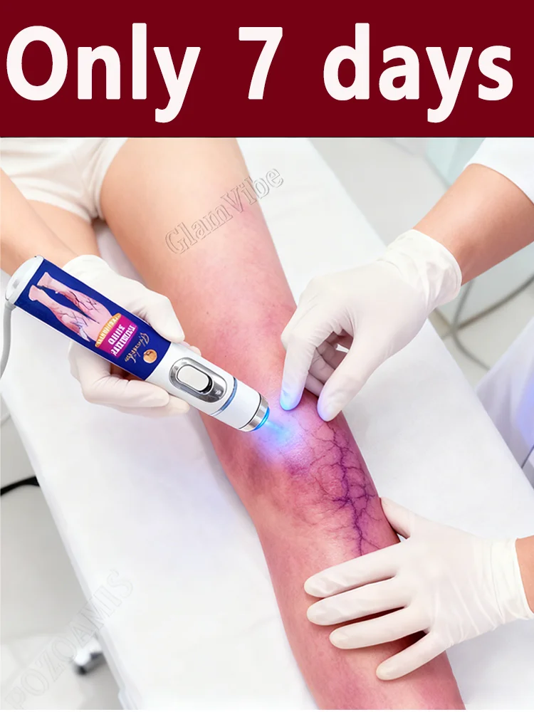 Bʟᴜᴇ ʟɪɢʜᴛ ʟᴀsᴇʀ ᴘᴇɴ ᴏ̨ᴜɪᴄᴋʟʏ ᴇʟɪᴍɪɴᴀᴛᴇs ᴠᴀʀɪᴄᴏsᴇ ᴠᴇɪɴs
Bʟᴜᴇ ʟɪɢʜᴛ ʟᴀsᴇʀ ᴘᴇɴ ᴏ̨ᴜɪᴄᴋʟʏ ᴇʟɪᴍɪɴᴀᴛᴇs ᴠᴀʀɪᴄᴏsᴇ ᴠᴇɪɴs