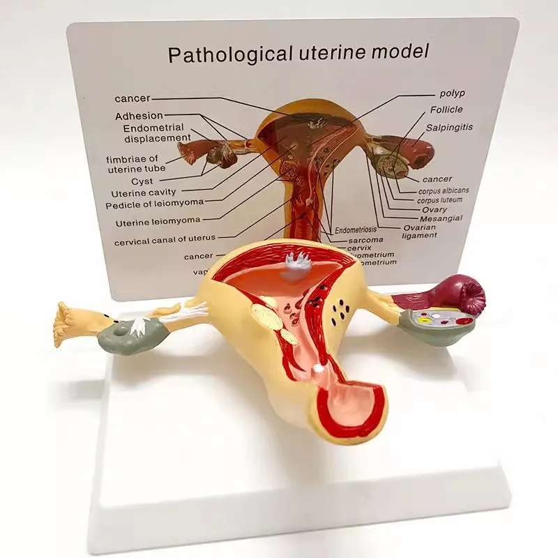 Human Uterusa nd Ovary Model Female Reproductive Uterine Organ Anatomical Model Medical Educational Tool
Human Uterusa nd Ovary Model Female Reproductive Uterine Organ Anatomical Model Medical Educational Tool