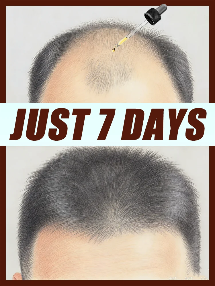 Solving problem of baldness ᵃⁿᵈ ʰᵉˡᵖⁱⁿᵍ ᵗᵒ ᑫᵘⁱᶜᵏˡʸ ᵖʳᵒᵐᵒᵗᵉ ʰᵃⁱʳ ᵍʳᵒʷᵗʰ ᵃⁿᵈ ᵈᵉⁿˢⁱ
Solving problem of baldness ᵃⁿᵈ ʰᵉˡᵖⁱⁿᵍ ᵗᵒ ᑫᵘⁱᶜᵏˡʸ ᵖʳᵒᵐᵒᵗᵉ ʰᵃⁱʳ ᵍʳᵒʷᵗʰ ᵃⁿᵈ ᵈᵉⁿˢⁱ