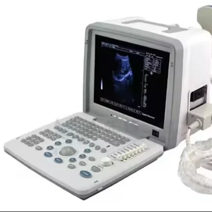 Portable Black and White Ultrasound Scanner Convex Linear Trans-vigianl Trans-rectal and Micro-convex Ultrasound Scanner
Portable Black and White Ultrasound Scanner Convex Linear Trans-vigianl Trans-rectal and Micro-convex Ultrasound Scanner