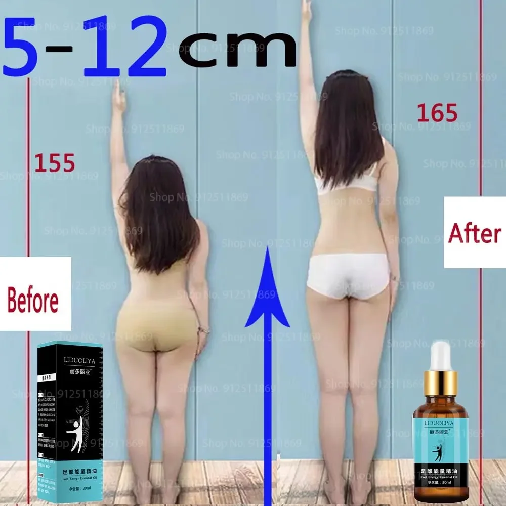 Lidoria Height Increasing Oil Grow Taller Lidoria Growth Essential Oil Foot Health Products Bone Growth Promote Second 30ML
Lidoria Height Increasing Oil Grow Taller Lidoria Growth Essential Oil Foot Health Products Bone Growth Promote Second 30ML