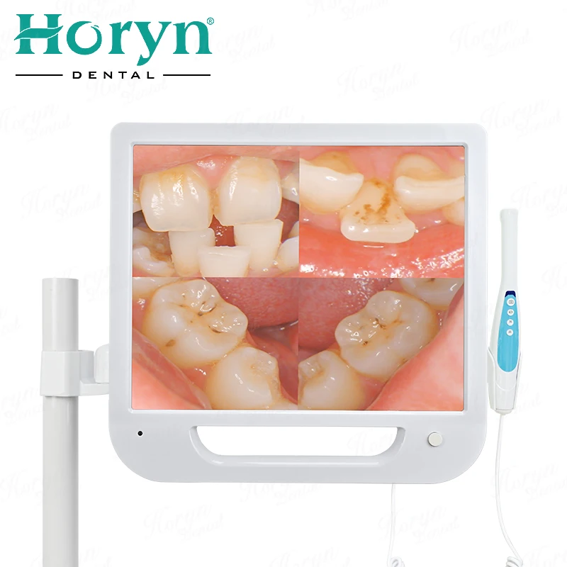 ден таль Эндоскоп 17 дюймов ЖК-7 тор VGA Intra Oral cam era 6LED Wi-Fi Цифровое радио ден tistry Intra Oral cam era 8 Million Pix
ден таль Эндоскоп 17 дюймов ЖК-7 тор VGA Intra Oral cam era 6LED Wi-Fi Цифровое радио ден tistry Intra Oral cam era 8 Million Pix