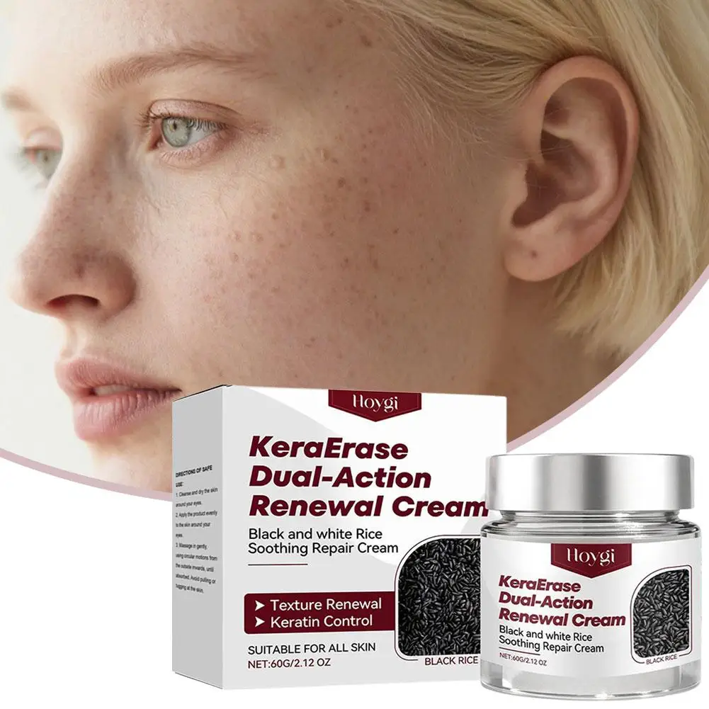 KeraErase Dual-Action Renewal Cream Delicate Skin Face Cream Black&White Rice Soothing Repair Cream FOR ALL SKIN Korean Skincare
KeraErase Dual-Action Renewal Cream Delicate Skin Face Cream Black&White Rice Soothing Repair Cream FOR ALL SKIN Korean Skincare