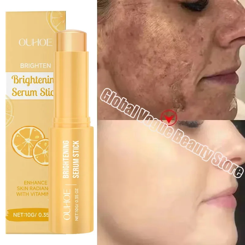 Vitamin C Whitening Cream Face Remove Dark Spots Freckles Fade Melanin Multi Balm Stick Brightening Korean Beauty Skin Care
Vitamin C Whitening Cream Face Remove Dark Spots Freckles Fade Melanin Multi Balm Stick Brightening Korean Beauty Skin Care